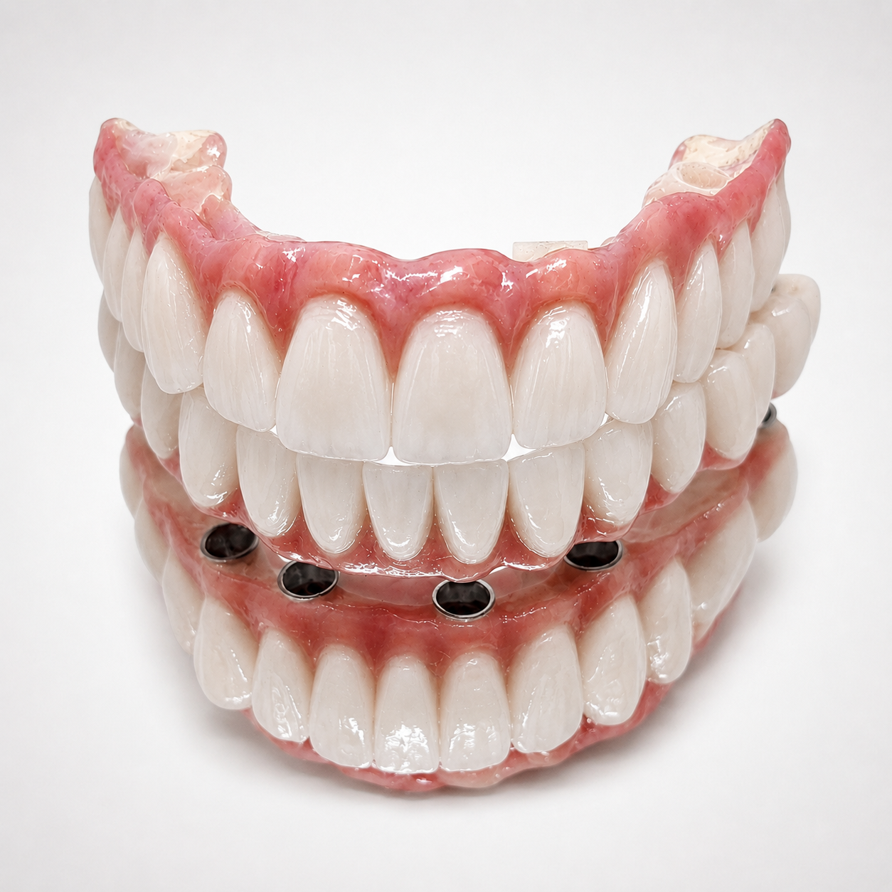 Protesi dentale fissa realizzata da H-Dent